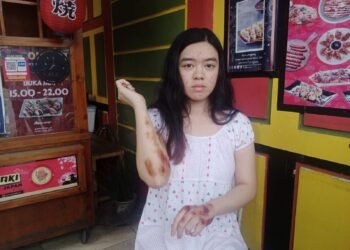 HP Dicuri Saat Layani Pembeli, Penjual Takoyaki di Cibinong Alami Luka Usai Terseret Motor Pencuri