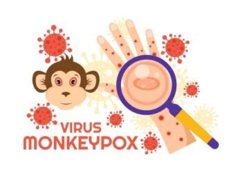 Tiga Warga Bogor Terdeteksi Monkeypox, Dinkes Tegaskan Semua Negatif Cacar Monyet 
