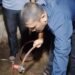 Gas Bocor Saat Hendak Memasak, Warga Parung Alami Luka Bakar