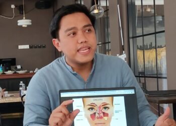 Jangan Anggap Sepele Sinusitis, Kenali Gejala dan Penanganannya