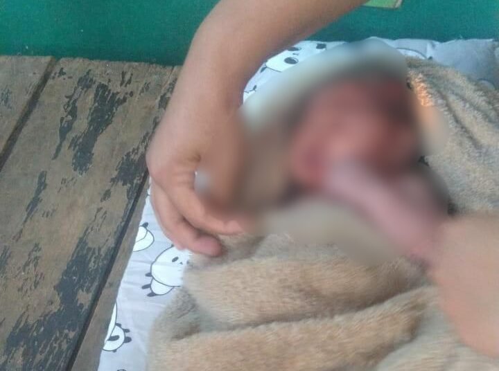 Diduga Dibuang, Bayi Perempuan Ditemukan di Semak-Semak Parung
