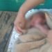 Diduga Dibuang, Bayi Perempuan Ditemukan di Semak-Semak Parung