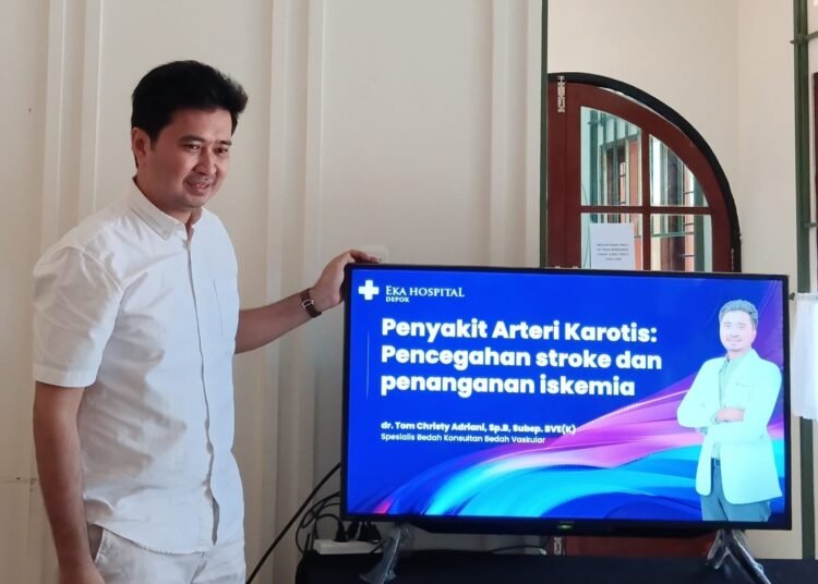 Intervensi Vaskular, Langkah Cepat Cegah Stroke Iskemik